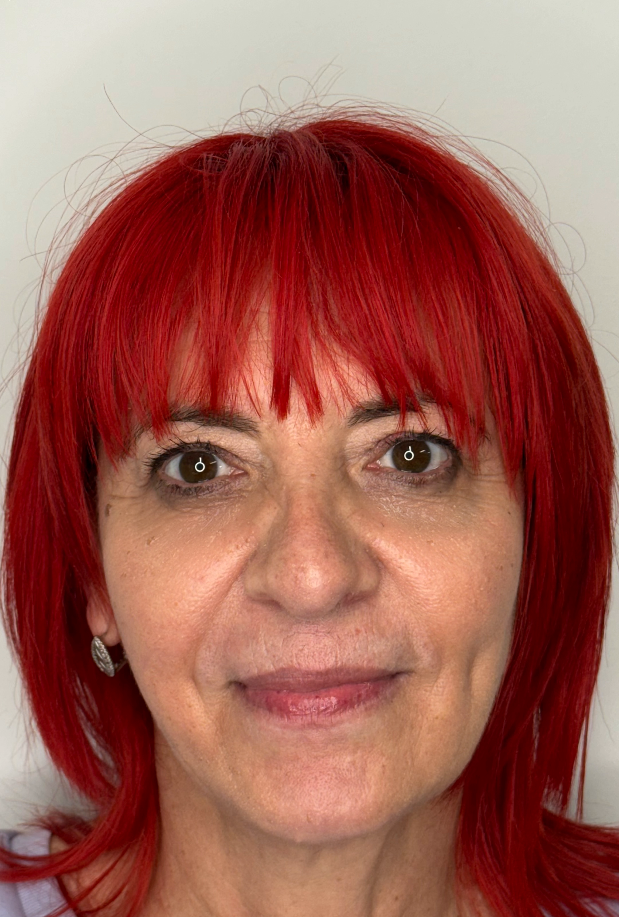 Before-and-after result