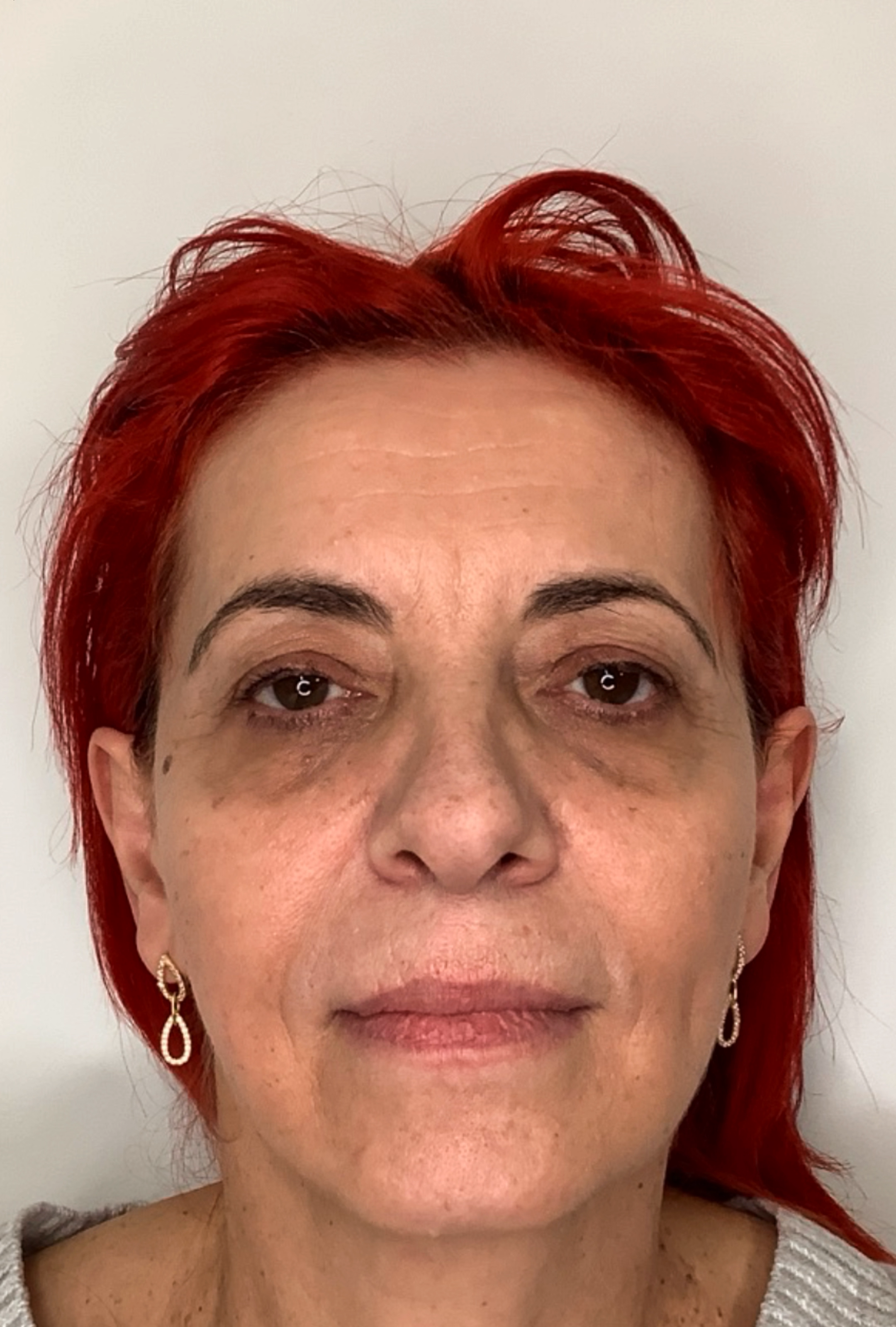 Before-and-after result