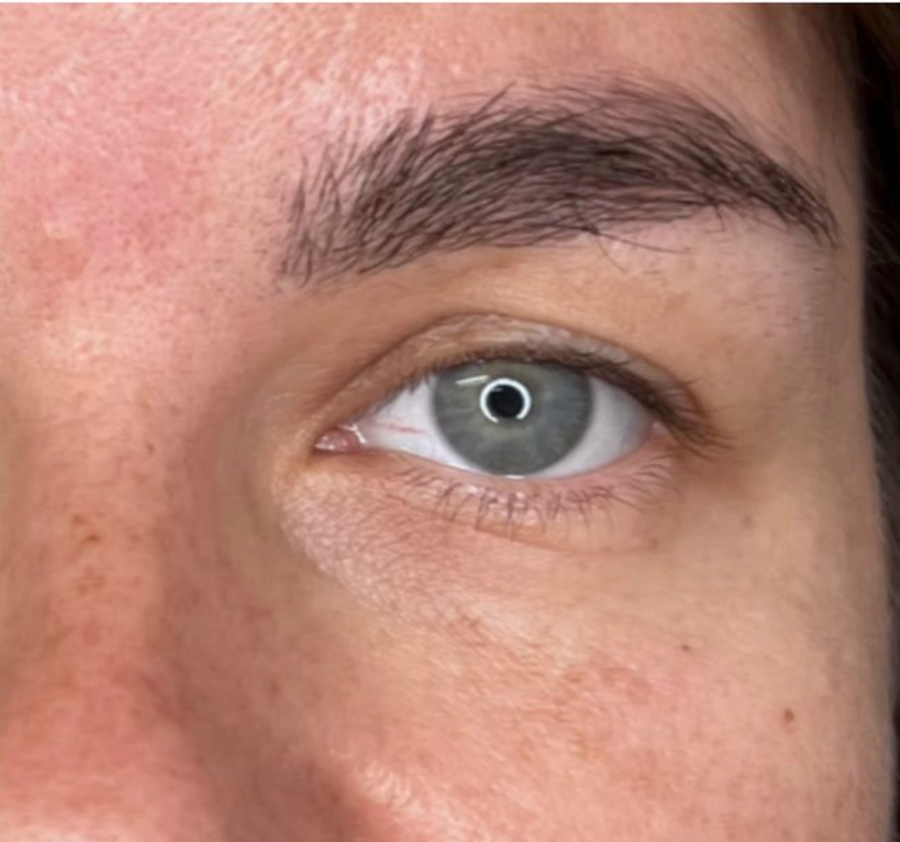 After treatment