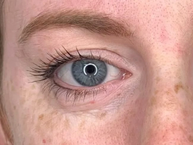 Before treatment