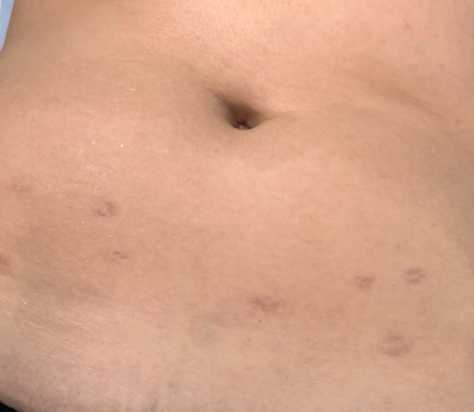 Before treatment