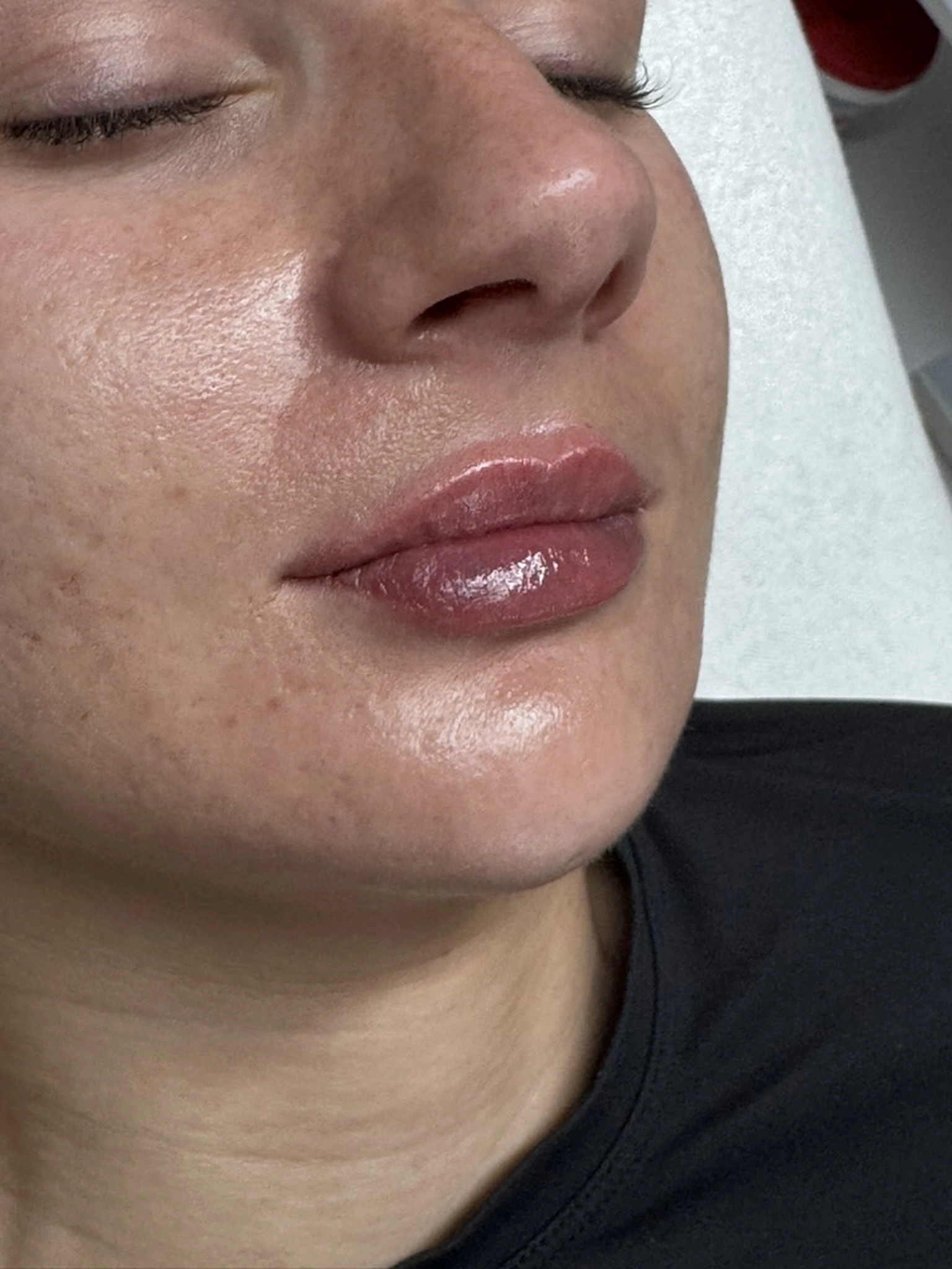 After treatment
