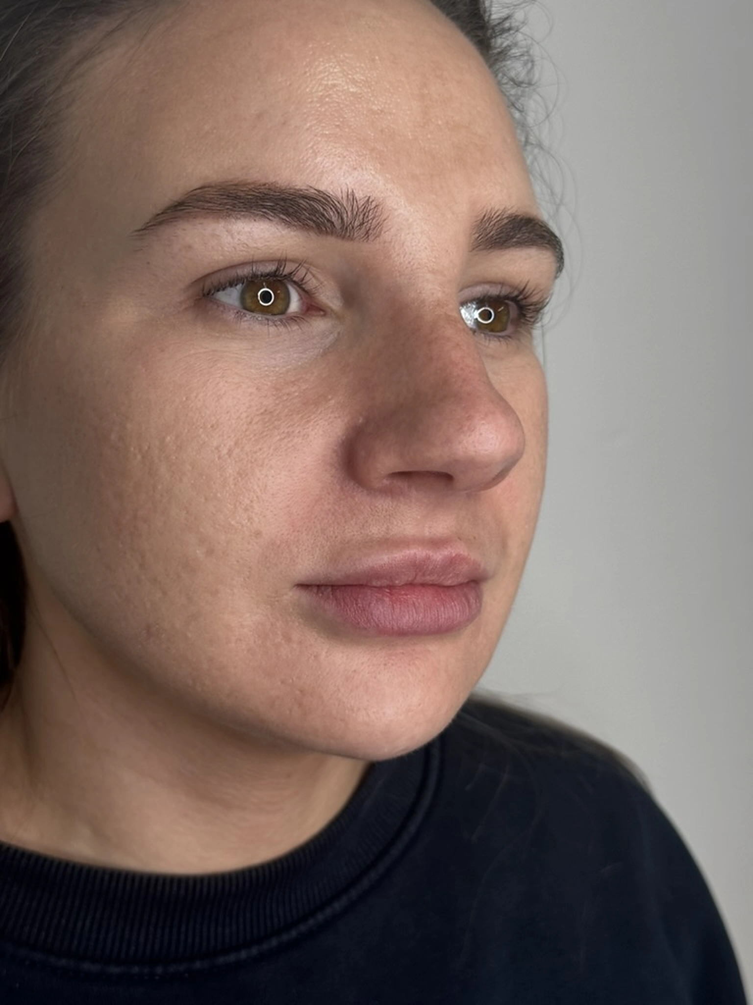Before treatment