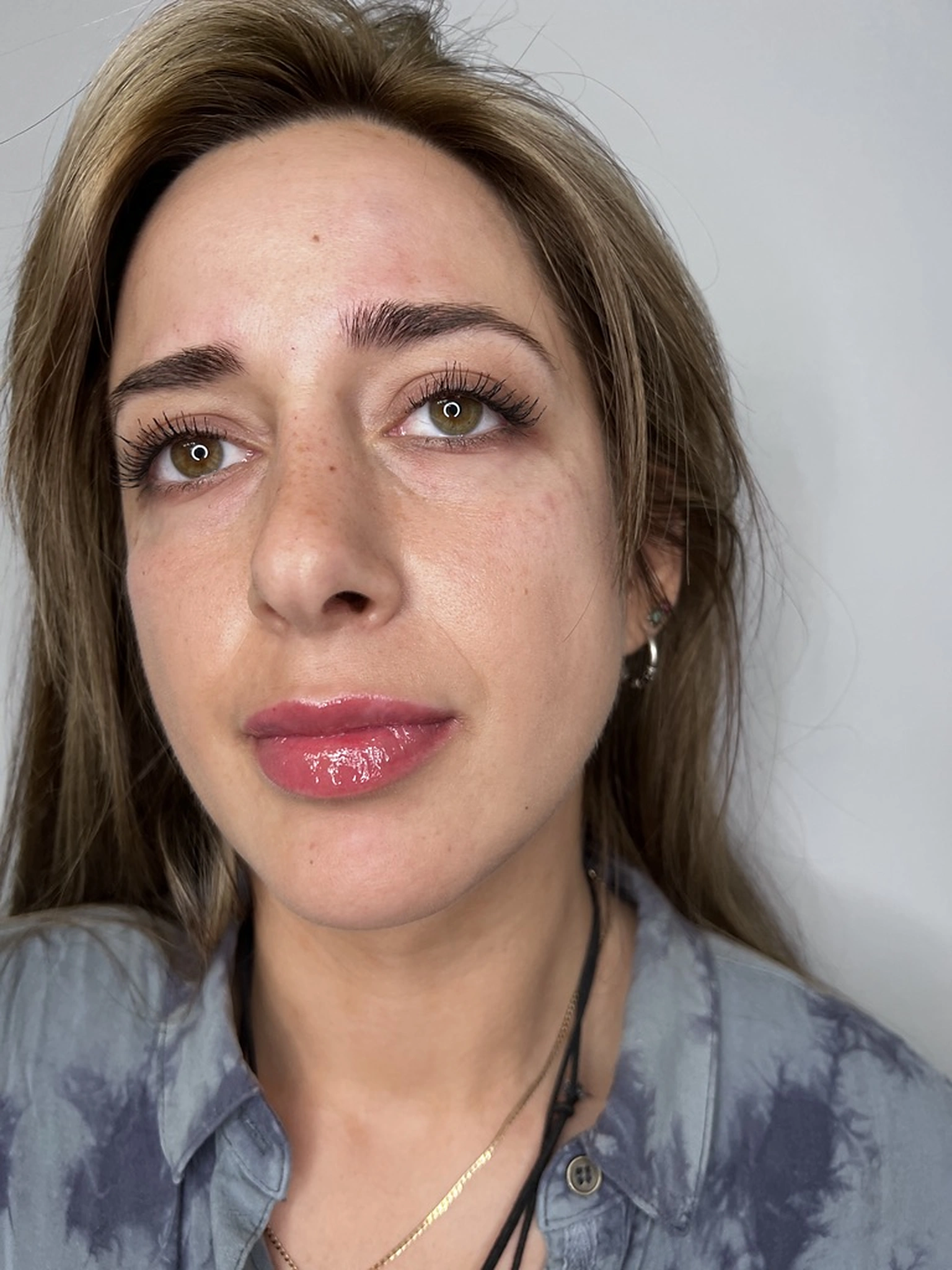 After treatment