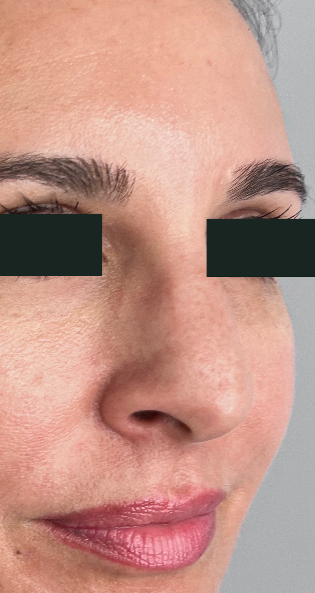 Before treatment
