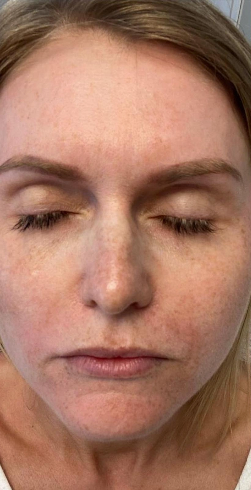 Before treatment