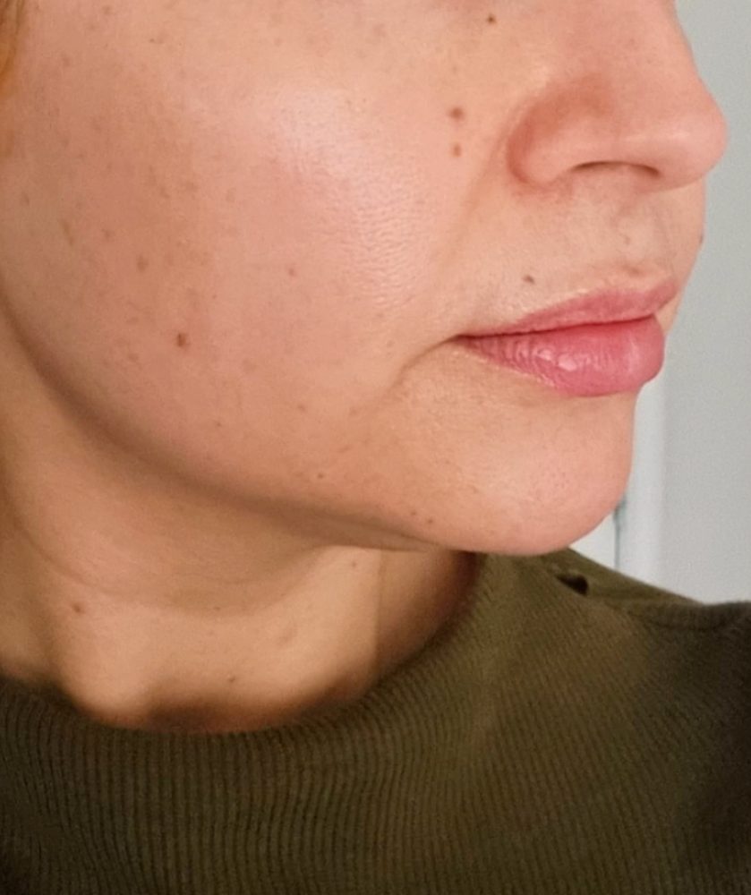 After treatment