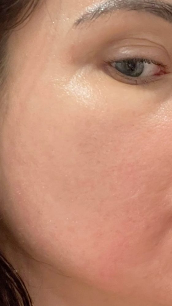 After treatment