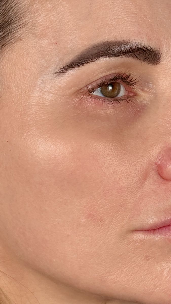 After treatment