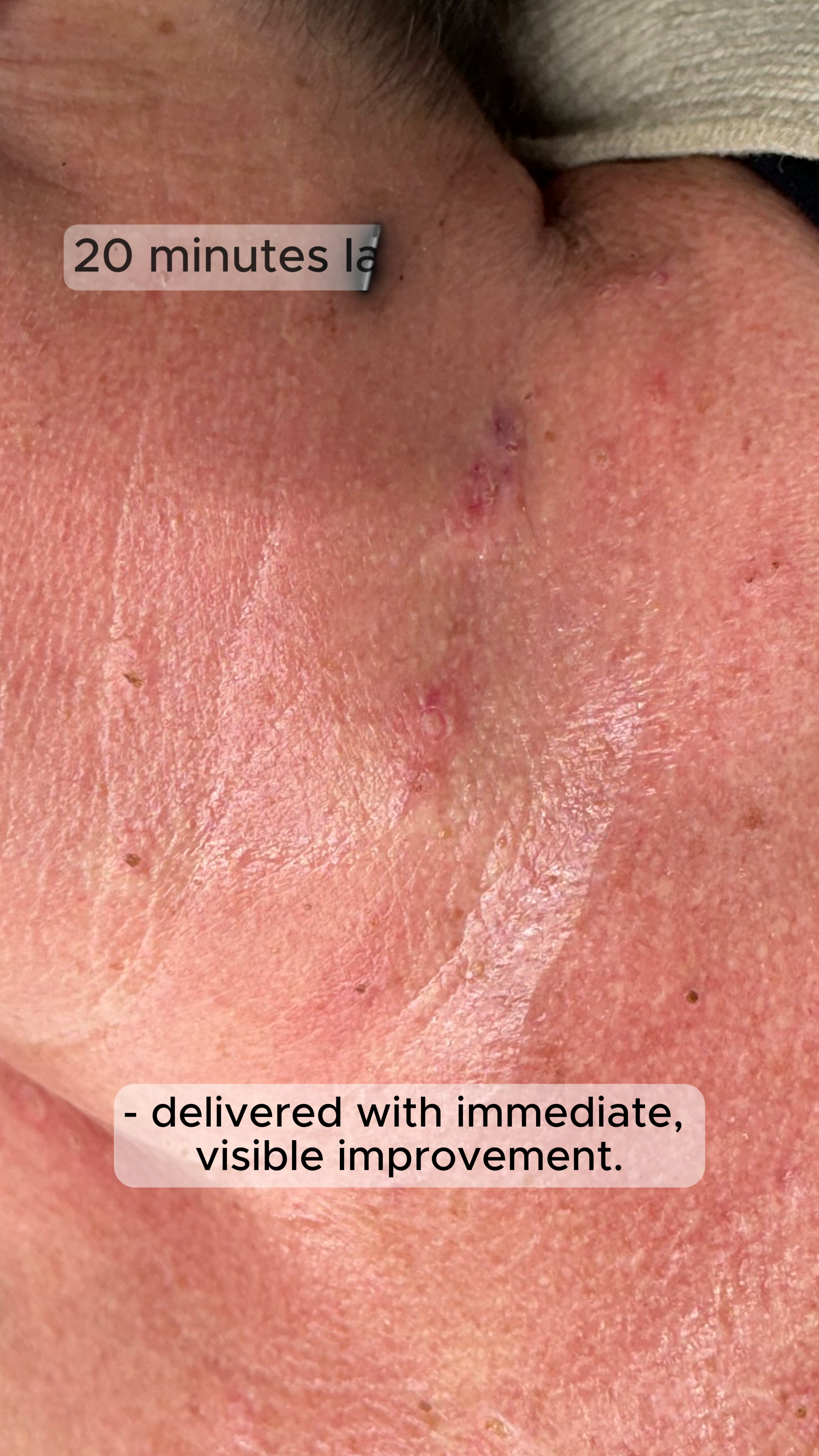 After treatment